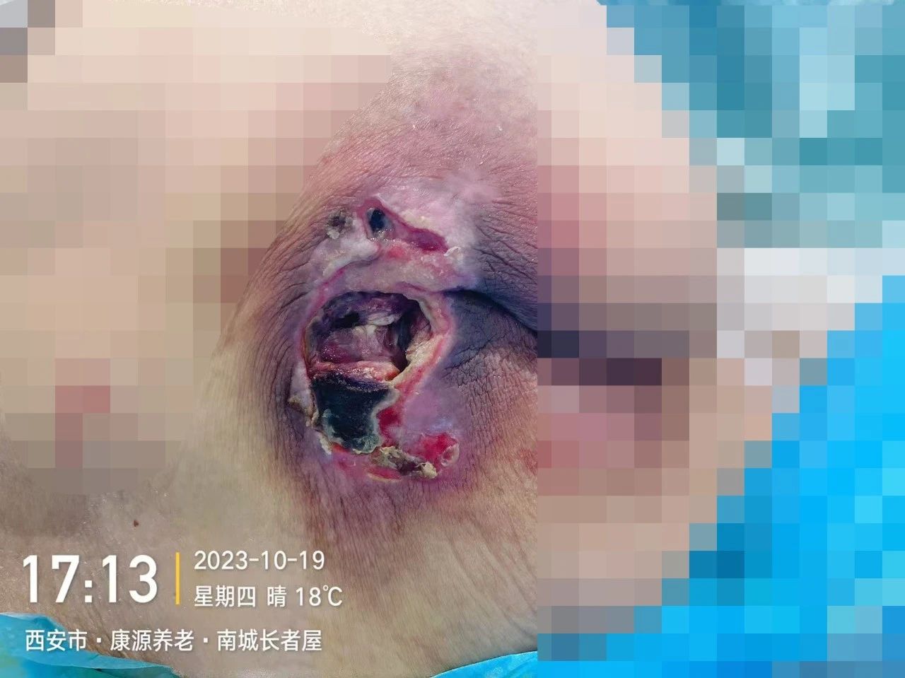 1742348373946010.jpg 2.jpg